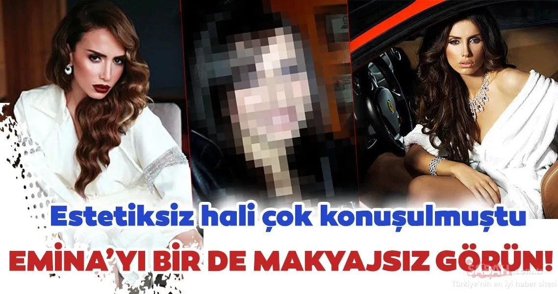Emina Jahović’in estetiksiz hali hayranlarını şaşırttı! Bu halini