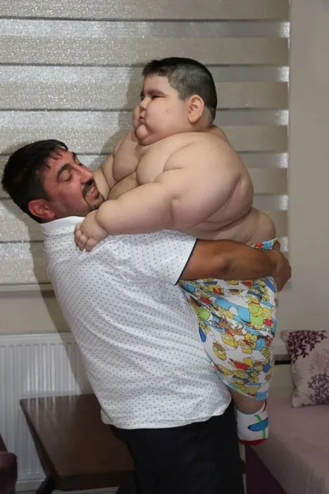 4 yaşında 70 kiloya ulaşan Yağız, yardım bekliyor