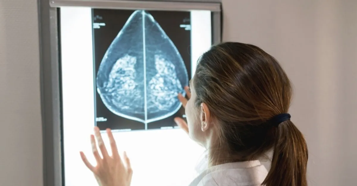 Tansiyon Yüksekliği Meme Kanseri Riskini Artırıyor Kadın Sağlığı