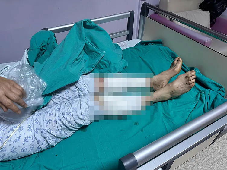 SON DAKİKA... 7 sokak köpeği 65 yaşındaki kadını parçaladı: Vücuduna tam 50 dikiş atıldı!