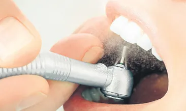 Diş çürümesine karşı aşı geliştiriliyor