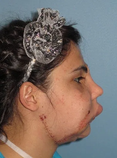 Hatice Nergis yeni yüzünü ilk kez gördü