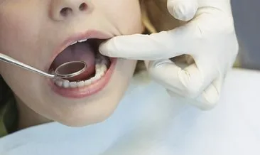 20’lik Diş Kaç Tane Olur? Yirmilik Diş Kaç Tane Çıkar, Üstte Çıkar Mı?