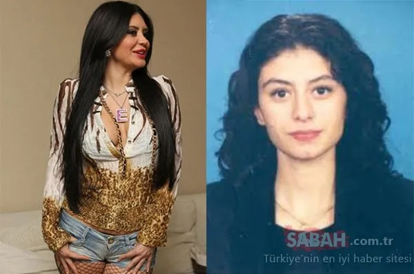 Estetik operasyonlarla bambaşka birine dönüşen ünlüler!