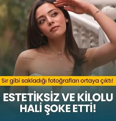 Sıla Türkoğlu’nun estetiksiz ve kilolu hali şoke etti!