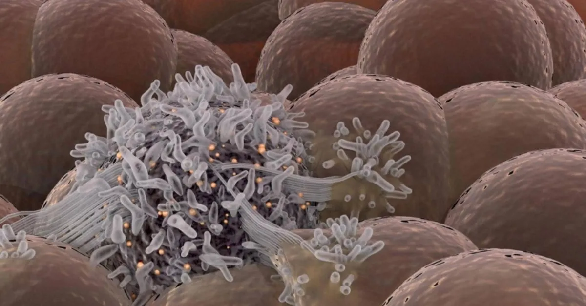 ilik kanseri belirtileri nelerdir