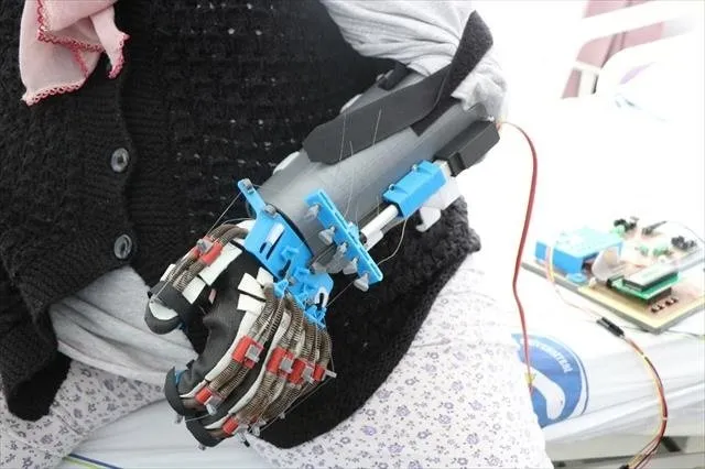 Bu robot elinde felç olan hastalara umut olacak!