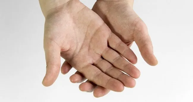 Avuc Ici Yanmasi Terlemesi Ve Kasinmasi Neden Olur Evde Nasil Gecer Avuc Ici Yanmasi Terlemesi Ve Kasinmasina Ne Iyi Gelir Saglik Haberleri Avuc Ici Yanmasi Terlemesi Ve Kasinmasi Neden Olur Evde Nasil Gecer Avuc Ici Yanmasi Terlemesi Ve Kasinmasina Ne Iyi Gelir Saglik Haberleri