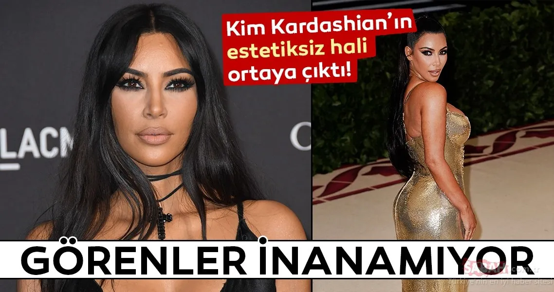 kim kardashian estetiksiz hali