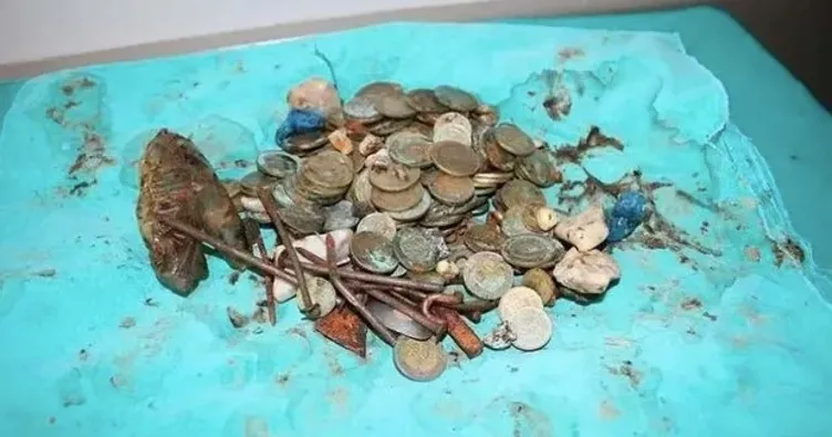 Midesinden 83 liralık madeni para çıktı