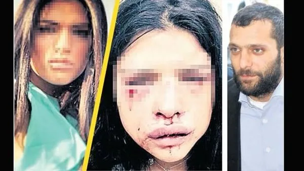 Melis, Onur Özbizerdik'ten böyle korunacak