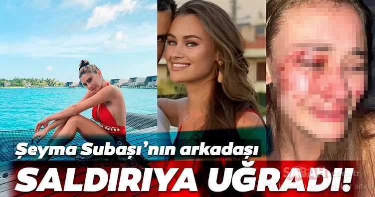 Şeyma Subaşı’nın model arkadaşı saldırıya uğradı! Son Dakika: Model Daria Kyryliuk dehşet görüntülerini paylaştı!