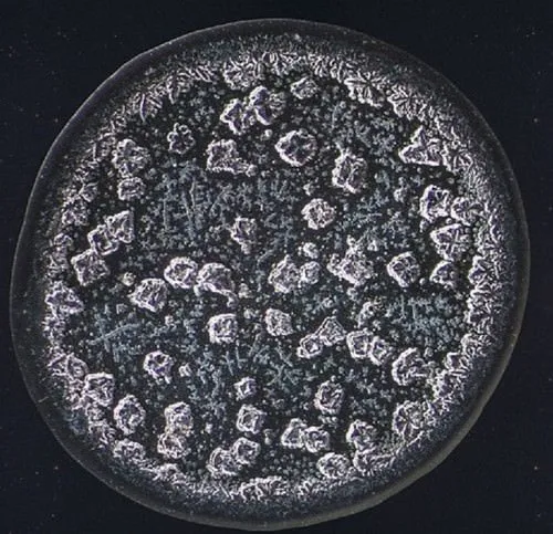 Mikroskobik Ortamda Gözyaşını Fotoğrafladı, Eşsiz Görüntüler Ortaya Çıktı