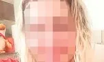SON DAKİKA | Estetik ameliyatı genç kadının kabusu oldu: Kulağını kesip yüzünü diktiler