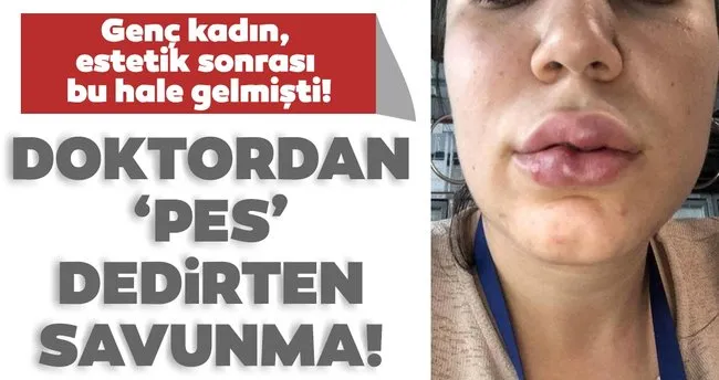 Dudak Estetigi Skandalinda Doktor Magdur Kadini Sucladi Son Dakika Haberler