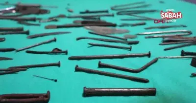 Van’da şoke eden olay! Midesinden çivi, bıçak, tırnak makası gibi 158 parça metal çıkarıldı | Video