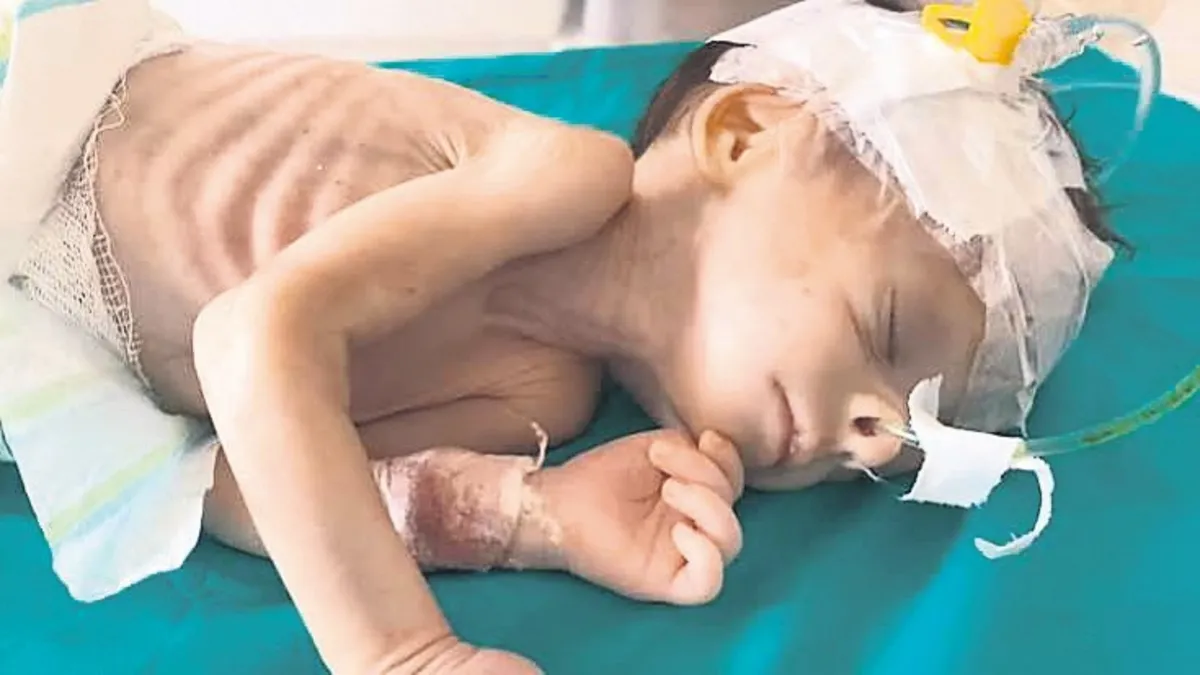 Gazze'de savaşın ortasında yaşam mücadelesi veren yeni doğan bebekler.