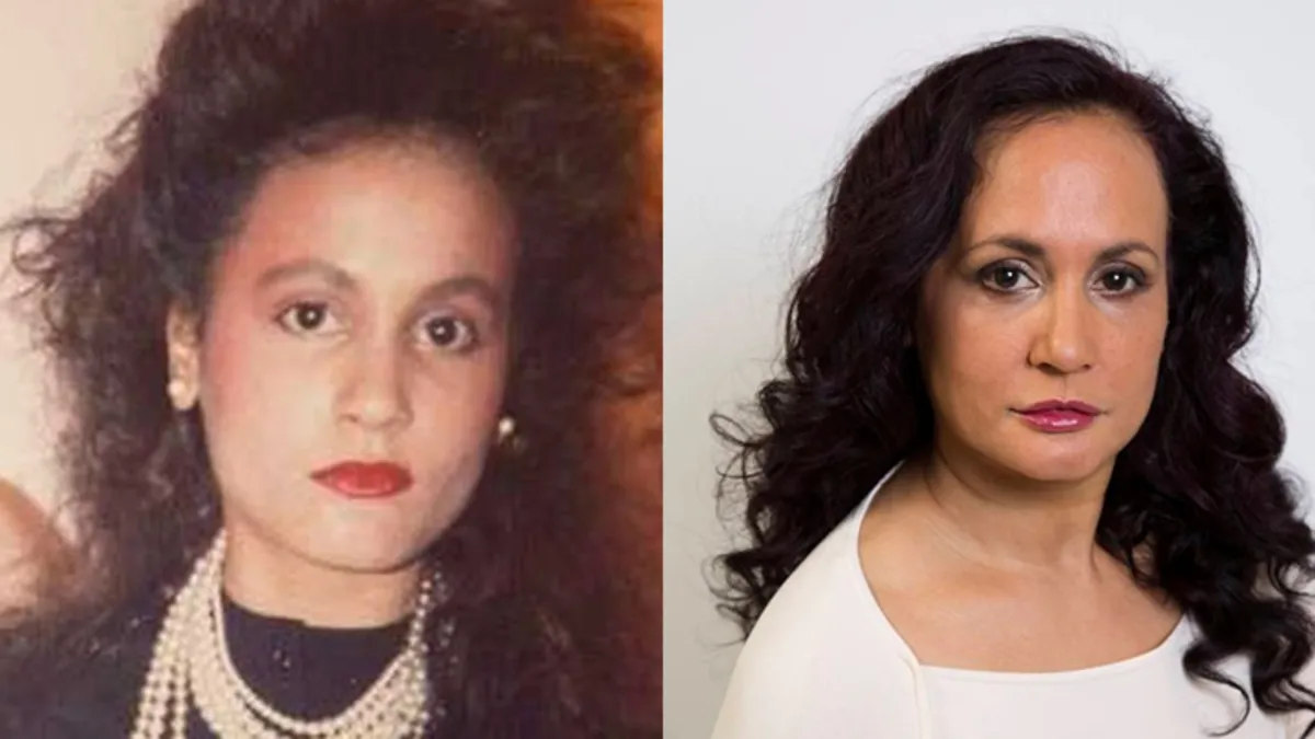 40 yıldır gülmüyor! Ardındaki neden herkesi şoke etti: Bu yöntem daha etkili...