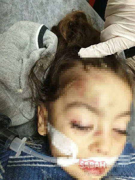SON DAKİKA! 3 yaşındaki kızın üzerine motosiklet düştü diye hastaneye kaldırdılar! Kan donduran gerçek ortaya çıktı
