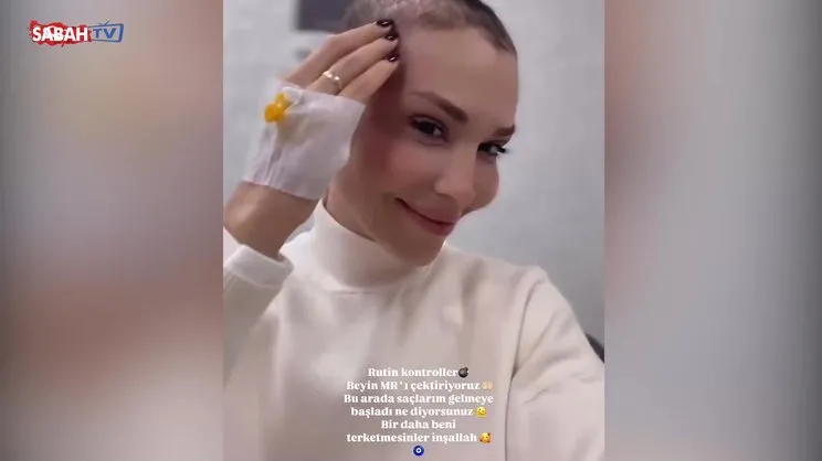 Eski sağlığına kavuşan şarkıcı Şimal: Saçlarım gelmeye başladı!