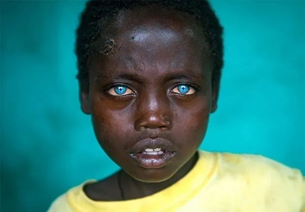 Deniz gözlü ’Afrikalı’ çocuk