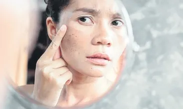 Cilt lekeleri çözümsüz değil