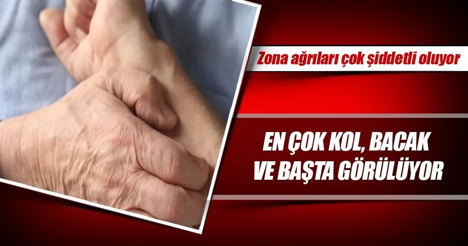 Zona Agrilari Cok Siddetli Oluyor Saglik Haberleri