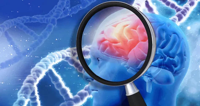 Beyinde Leke Tedavisi Nasil Yapilir Beyinde Leke Neden Olusur Son Dakika Haberler