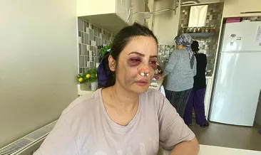 Silahı tutukluk yapınca darp etti