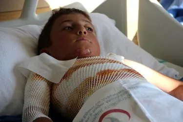 10 Yasindaki Cocuk Dehseti Yasadi Gomlegindeki Ipi Yakmak Isterken Kendini Yakti Son Dakika Haberler