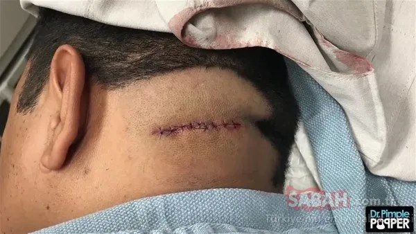 Doktora bu halde geldi! Sonrasındaysa...