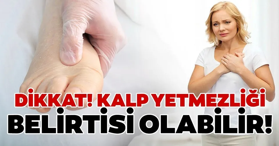 Dikkat Kalp Yetmezligi Belirtisi Olabilir Saglik Haberleri