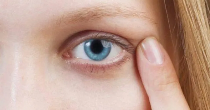 sarimsak ile gozdeki arpacik nasil gecer saglik haberleri