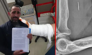 Kocaeli’de akılalmaz olay! Bayramda kesilen parmağı hayatını kararttı: Başına gelmeyen kalmadı! #kocaeli