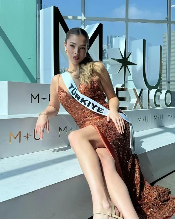 Miss Universe Kainat Güzellik Yarışması’nda Türkiye’yi temsil eden Ayliz Duman’ın 90 kilo olduğu yıllardan görüntüsü şaşırttı!