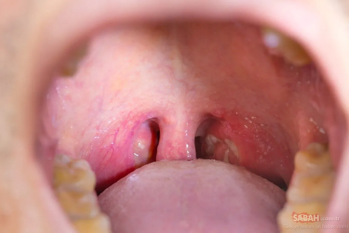 antibiyotikleri atin bu dogal cozum onlarin yerini alacak galeri kadin