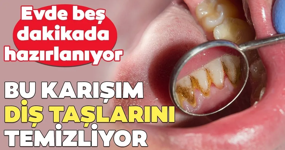 Dis Taslarini Yok Ediyor Son Dakika Haberler