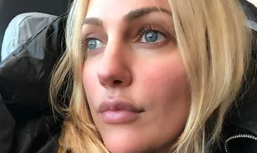 Meryem Uzerli, yine estetik yaptırdı