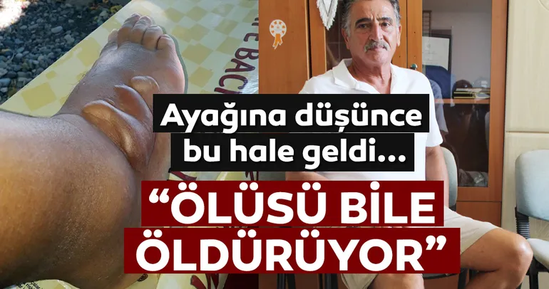Ayağına düşen ’aslan balığı’ öldürüyordu