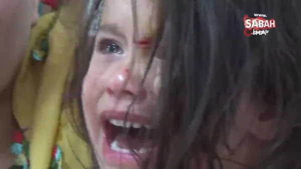 Mardin'de 3 yaşındaki kıza sokak köpekleri saldırdı