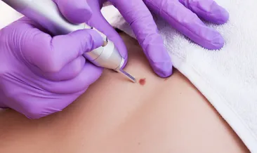 Siğiller hakkında bilinmesi gerekenler