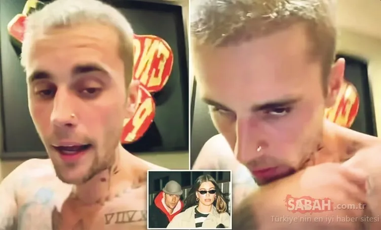 Justin Bieber’ın son hali sevenlerini endişelendirdi! Yardıma ihtiyacı var