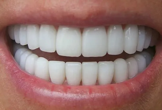 Diş hassasiyetini etkiliyor!