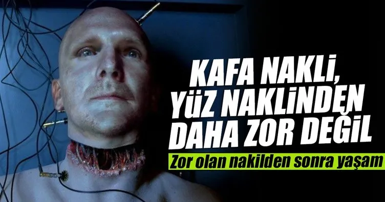 Kafa Nakli Yuz Naklinden Daha Zor Degil Sayfa 2 En Son Haber