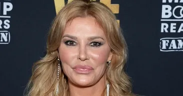 Yüzü adeta eriyordu! Şov yıldızı Brandi Glanville’i sarsan hastalığın sebebi belli oldu...