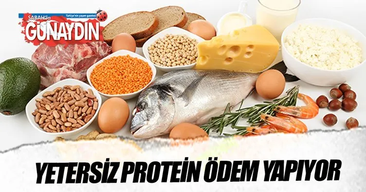 Yetersiz protein ödem yapıyor