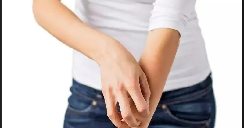 Sivilce Nasil Gecer Ve Sivilceye Ne Iyi Gelir Yuzdeki Sivilce Icin Lekelere Iyi Gelen Seyler Saglik Haberleri