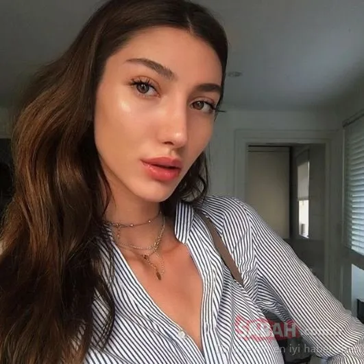 Miss Turkey ödülü doktorun hakkı! Şevval Şahin�in estetiksiz hali olay