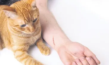 ‘Kedi tırmığı’ deyip geçmeyin!