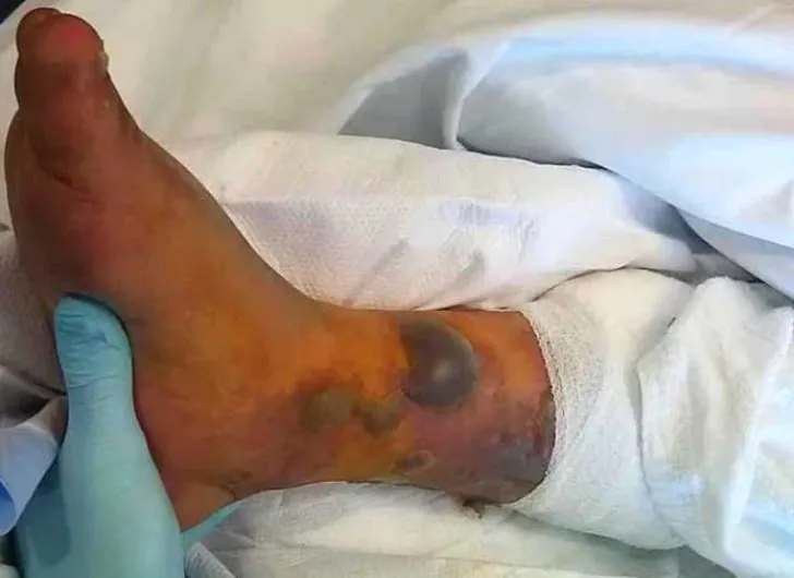 Dövme yaptırdılar sonucu bakın ne oldu!